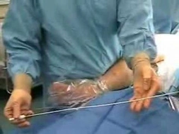 Açık Varis Ameliyatı Riskleri ve Sonrası