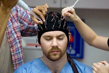 Epilepsi Ameliyatı Riskleri ve Sonrası